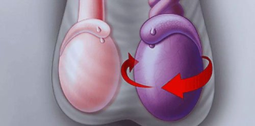 Torsion Testes Treatment in Nagpur